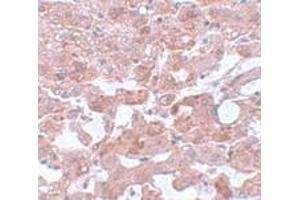 Immunohistochemistry (IHC) image for anti-Cell Division Cycle 16 Homolog (S. Cerevisiae) (CDC16) (N-Term) antibody (ABIN1031232) (CDC16 Antikörper  (N-Term))