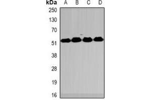 Western blot analysis of MeCP2 expression in HT29 (A), Jurkat (B), mouse spleen (C), mouse lung (D) whole cell lysates. (MECP2 Antikörper)