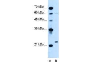 Western Blotting (WB) image for anti-Immunoglobulin lambda-Like Polypeptide 1 (IGLL1) antibody (ABIN2462601) (IGLL1 Antikörper)