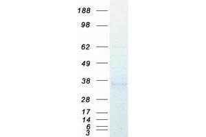 Western Blotting (WB) image for Acid Phosphatase 5, Tartrate Resistant (ACP5) (Transcript Variant 4) protein (Myc-DYKDDDDK Tag) (ABIN2714337)