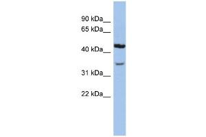 WB Suggested Anti-KCNK4 Antibody Titration:  0.