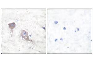 Immunohistochemical analysis of paraffin-embedded human brain tissue using SNAP25 antibody (ABIN5976506). (SNAP25 Antikörper  (C-Term))
