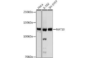 Western blot analysis of extracts of various cell lines, using N antibody (ABIN7268774) at 1:1000 dilution. (NAT10 Antikörper)