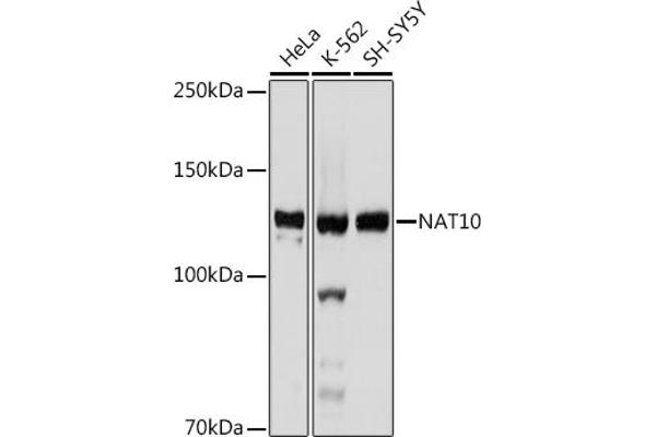 NAT10 Antikörper