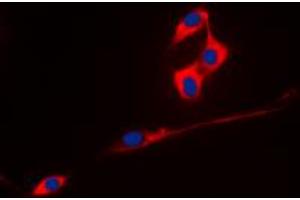 Immunofluorescent analysis of ECHOS1 staining in A431 cells.