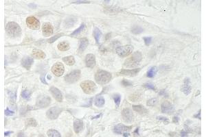 anti-Breast Carcinoma Amplified Sequence 3 (BCAS3) (C-Term) antibody
