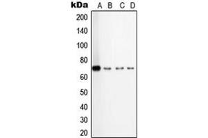 Western blot analysis of TGFBR2 expression in HepG2 (A), A549 (B), TF1 (C), KNRK (D) whole cell lysates. (TGFBR2 Antikörper  (Center))