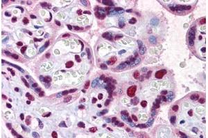 Human Placenta: Formalin-Fixed, Paraffin-Embedded (FFPE) (SCML1 Antikörper  (AA 3-101))