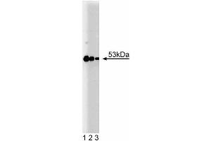 Western blot analysis of PKA RIIbeta on human endothelial lysate (left). (PRKAR2B Antikörper  (AA 1-418))