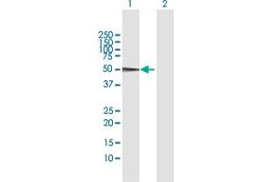 Western Blot analysis of CPB2 expression in transfected 293T cell line by CPB2 MaxPab polyclonal antibody. (CPB2 Antikörper  (AA 1-423))