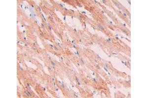 Used in DAB staining on fromalin fixed paraffin- embedded heart tissue (SNCAIP Antikörper  (AA 766-963))