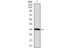 Western blot analysis using LPA mAb against human LPA recombinant protein. (LPA Antikörper  (AA 4330-4521))