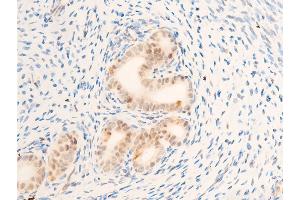 Immunohistochemistry (IHC) image for anti-Myc Proto-Oncogene protein (MYC) (pThr58) antibody (ABIN6256584)