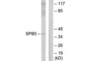 Western blot analysis of extracts from HeLa cells, using Serpin B5 Antibody. (SERPINB5 Antikörper  (AA 91-140))