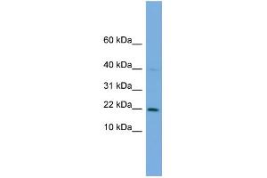 WB Suggested Anti-C7orf16 Antibody Titration: 0. (G Substrate Antikörper  (Middle Region))