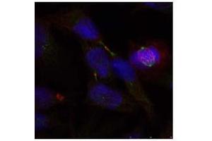 Image no. 2 for anti-ELK1, Member of ETS Oncogene Family (ELK1) (Ser389) antibody (ABIN197161) (ELK1 Antikörper  (Ser389))