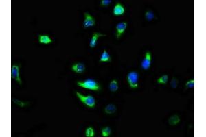 Immunofluorescence staining of A549 cells with ABIN7147330 at 1:100, counter-stained with DAPI. (TMEM2 Antikörper  (AA 734-866))
