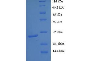 SDS-PAGE (SDS) image for Ephrin B3 (EFNB3) (AA 28-227) protein (His tag) (ABIN5713416) (Ephrin B3 Protein (EFNB3) (AA 28-227) (His tag))