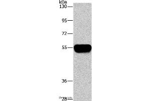 Western blot analysis of Human plasma tissue, using AHSG Polyclonal Antibody at dilution of 1:1450 (Fetuin A Antikörper)