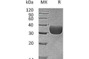 Western Blotting (WB) image for Coxsackie Virus and Adenovirus Receptor (CXADR) protein (His tag,AVI tag) (ABIN7320866) (Coxsackie Adenovirus Receptor Protein (His tag,AVI tag))