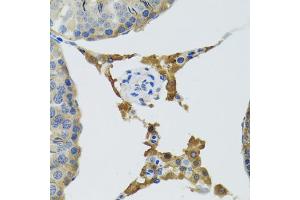 Immunohistochemistry of paraffin-embedded mouse testis using PLA2G2D antibody (ABIN5974036) at dilution of 1/100 (40x lens). (PLA2G2D Antikörper)