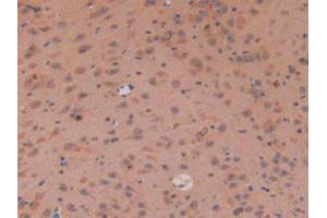 IHC-P analysis of Mouse Brain Tissue, with DAB staining. (APC Antikörper  (AA 2636-2845))