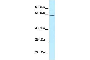 WB Suggested Anti-CCT3 Antibody Titration: 1. (CCT3 Antikörper  (C-Term))