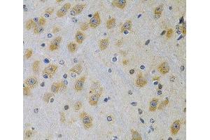 Immunohistochemistry of paraffin-embedded Rat brain using IGFBP4 Polyclonal Antibody at dilution of 1:100 (40x lens).