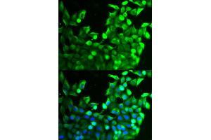 Immunofluorescence analysis of MCF-7 cells using FGFR2 antibody (ABIN5971103). (FGFR2 Antikörper)
