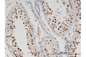 Image no. 1 for anti-tyrosyl-DNA phosphodiesterase 2 (TDP2) (AA 1-363) antibody (ABIN599560) (TDP2 Antikörper  (AA 1-363))