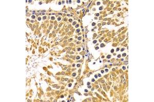 Immunohistochemistry of paraffin-embedded rat testis using PIBF1 Antibody. (PIBF1 Antikörper)