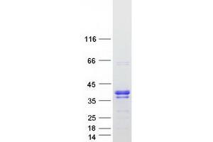 Validation with Western Blot (RRP15 Protein (Myc-DYKDDDDK Tag))