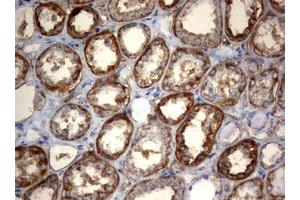Image no. 2 for anti-3-Oxoacyl-ACP Synthase, Mitochondrial (OXSM) (AA 78-343) antibody (ABIN1491676) (OXSM Antikörper  (AA 78-343))