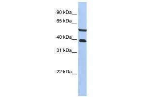 PHACTR3 antibody used at 1 ug/ml to detect target protein. (PHACTR3 Antikörper  (C-Term))