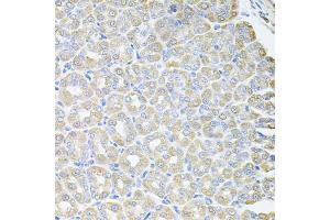 Immunohistochemistry of paraffin-embedded mouse stomach using SKAP2 antibody. (SKAP2 Antikörper)