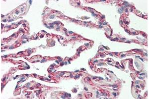 Image no. 2 for anti-TNFRSF1A-Associated Via Death Domain (TRADD) (AA 251-300) antibody (ABIN2879132) (TRADD Antikörper  (AA 251-300))