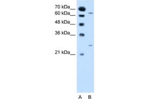 Western Blotting (WB) image for anti-N-Acetyltransferase 2 (Arylamine N-Acetyltransferase) (NAT2) antibody (ABIN2462790) (NAT2 Antikörper)