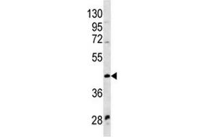 Western Blotting (WB) image for anti-Wingless-Type MMTV Integration Site Family, Member 9A (WNT9A) (AA 216-244) antibody (ABIN3029639)