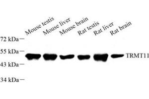 Western blot analysis of TRMT11 (ABIN7076023) at dilution of 1: 1000