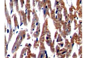 DAB staining on IHC-P; Samples: Rat Cardiac Muscle Tissue