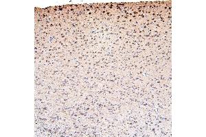 IHC analysis of CDK5 using anti-CDK5 antibody (ABIN6719393). (CDK5 Antikörper  (AA 1-226))