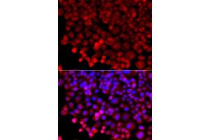Immunofluorescence analysis of A549 cell using HARS antibody. (HARS1/Jo-1 Antikörper)