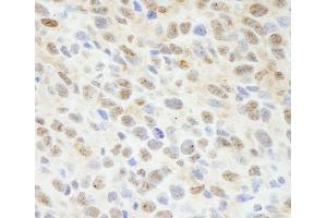 Immunohistochemistry (IHC) image for anti-Mitogen-Activated Protein Kinase Associated Protein 1 (MAPKAP1) (C-Term) antibody (ABIN7448795) (MAPKAP1 Antikörper  (C-Term))