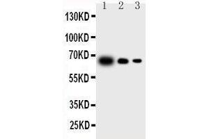 Western Blotting (WB) image for anti-Interleukin 23, alpha subunit p19 (IL23A) (AA 29-48), (N-Term) antibody (ABIN3043197) (IL23A Antikörper  (N-Term))