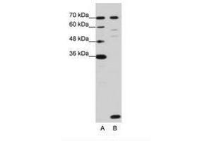 Image no. 3 for anti-LSM2 Homolog, U6 Small Nuclear RNA Associated (LSM2) (C-Term) antibody (ABIN202014) (LSM2 Antikörper  (C-Term))