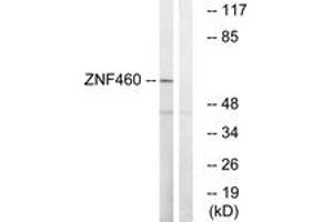 Western blot analysis of extracts from LOVO cells, using ZNF460 Antibody. (ZNF460 Antikörper  (AA 461-510))