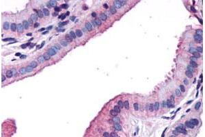 Immunohistochemical staining of human gallbladder, epithelium with CCKAR polyclonal antibody . (CCKAR Antikörper  (N-Term))