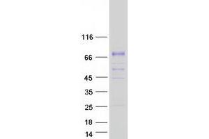 Western Blotting (WB) image for Kallikrein B, Plasma (Fletcher Factor) 1 (KLKB1) protein (Myc-DYKDDDDK Tag) (ABIN2724400)