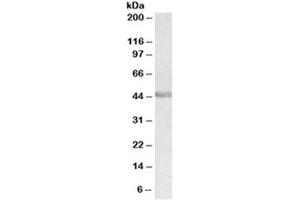 Western blot testing of human duodenum lysate with PAX3 antibody at 0. (Paired Box 3 Antikörper)