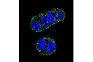 Confocal immunofluorescent analysis of FOLH1 Antibody (N-term) (ABIN657630 and ABIN2846626) with ZR-75-1 cell followed by Alexa Fluor 488-conjugated goat anti-rabbit lgG (green). (PSMA Antikörper  (N-Term))